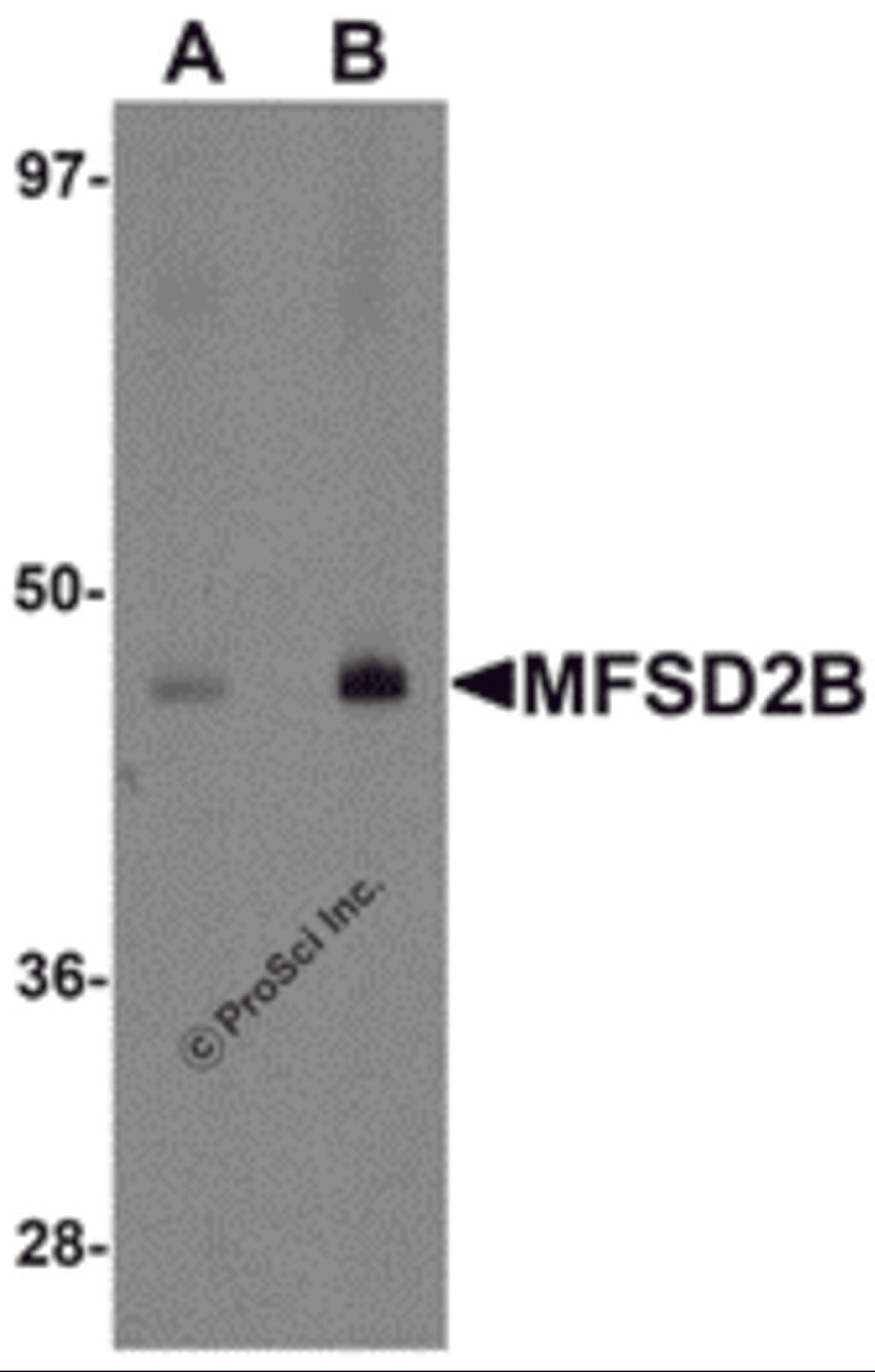 Western blot analysis of MFSD2B in rat lung tissue lysate with MFSD2B antibody at (A) 1 and (B) 2 μg/mL.