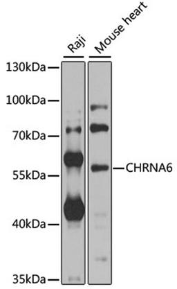 Western blot - CHRNA6 antibody (A8470)