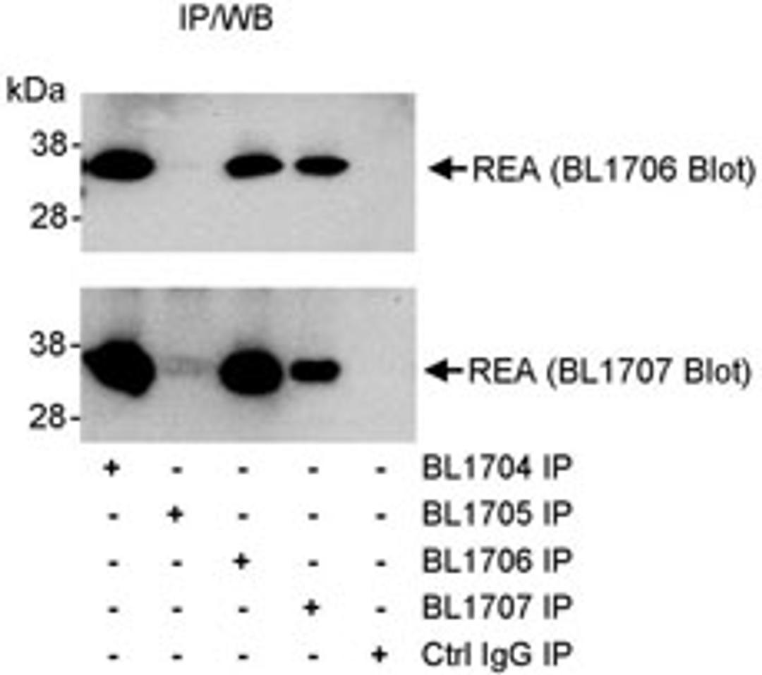 Detection of human REA by western blot of immunoprecipitates.