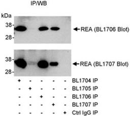 Detection of human REA by western blot of immunoprecipitates.