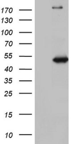 Western Blot: NUDT12 Antibody (2G2) [NBP2-46275] - Analysis of HEK293T cells were transfected with the pCMV6-ENTRY control (Left lane) or pCMV6-ENTRY NUDT12.