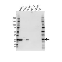 Western blot analysis of whole cell lysates probed with Bcl-2 antibody