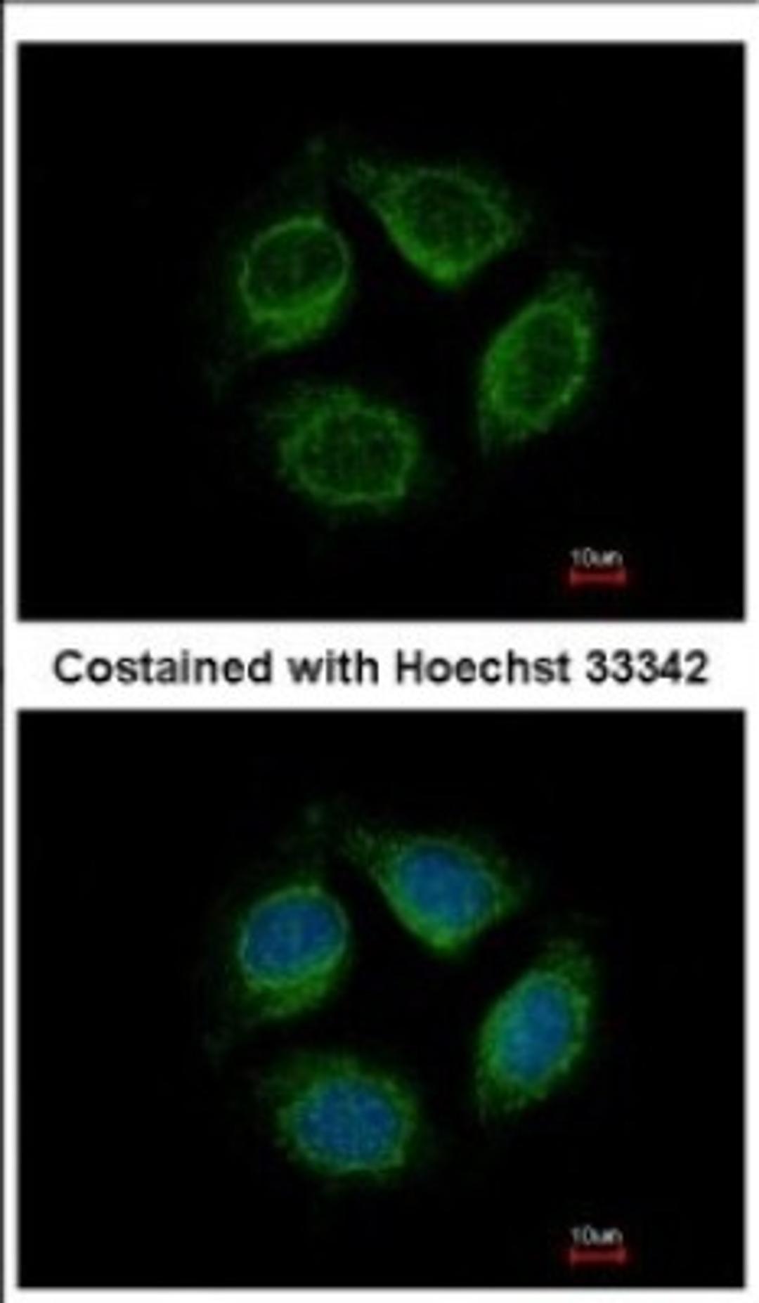 Immunocytochemistry/Immunofluorescence: Netrin G1 ligand Antibody [NBP2-19516] - Immunofluorescence analysis of methanol-fixed MCF-7, using antibody at 1:500 dilution.