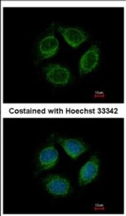 Immunocytochemistry/Immunofluorescence: Netrin G1 ligand Antibody [NBP2-19516] - Immunofluorescence analysis of methanol-fixed MCF-7, using antibody at 1:500 dilution.