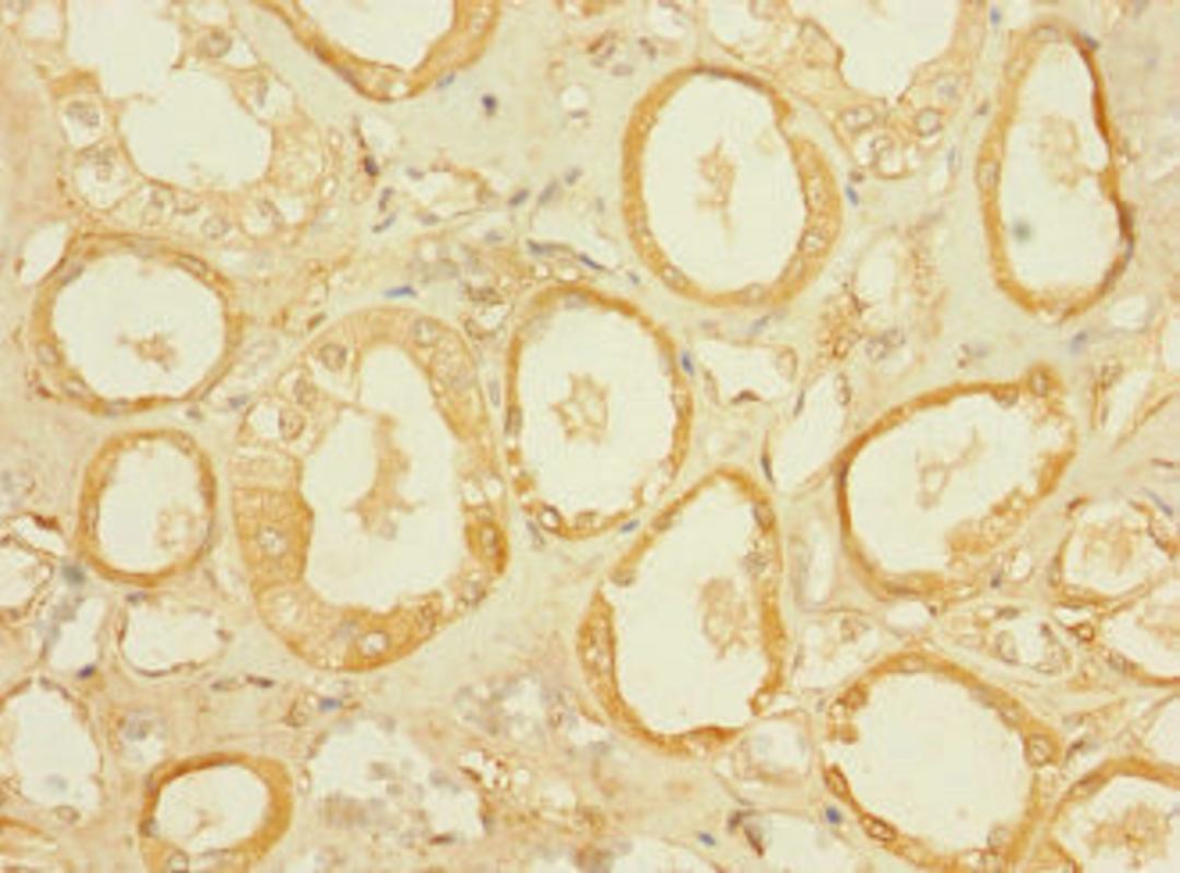 Immunohistochemistry of paraffin-embedded human kidney tissue using CSB-PA021679LA01HU at dilution of 1:100