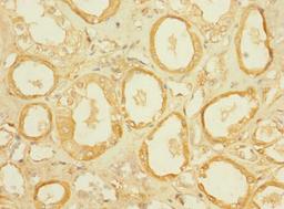 Immunohistochemistry of paraffin-embedded human kidney tissue using CSB-PA021679LA01HU at dilution of 1:100