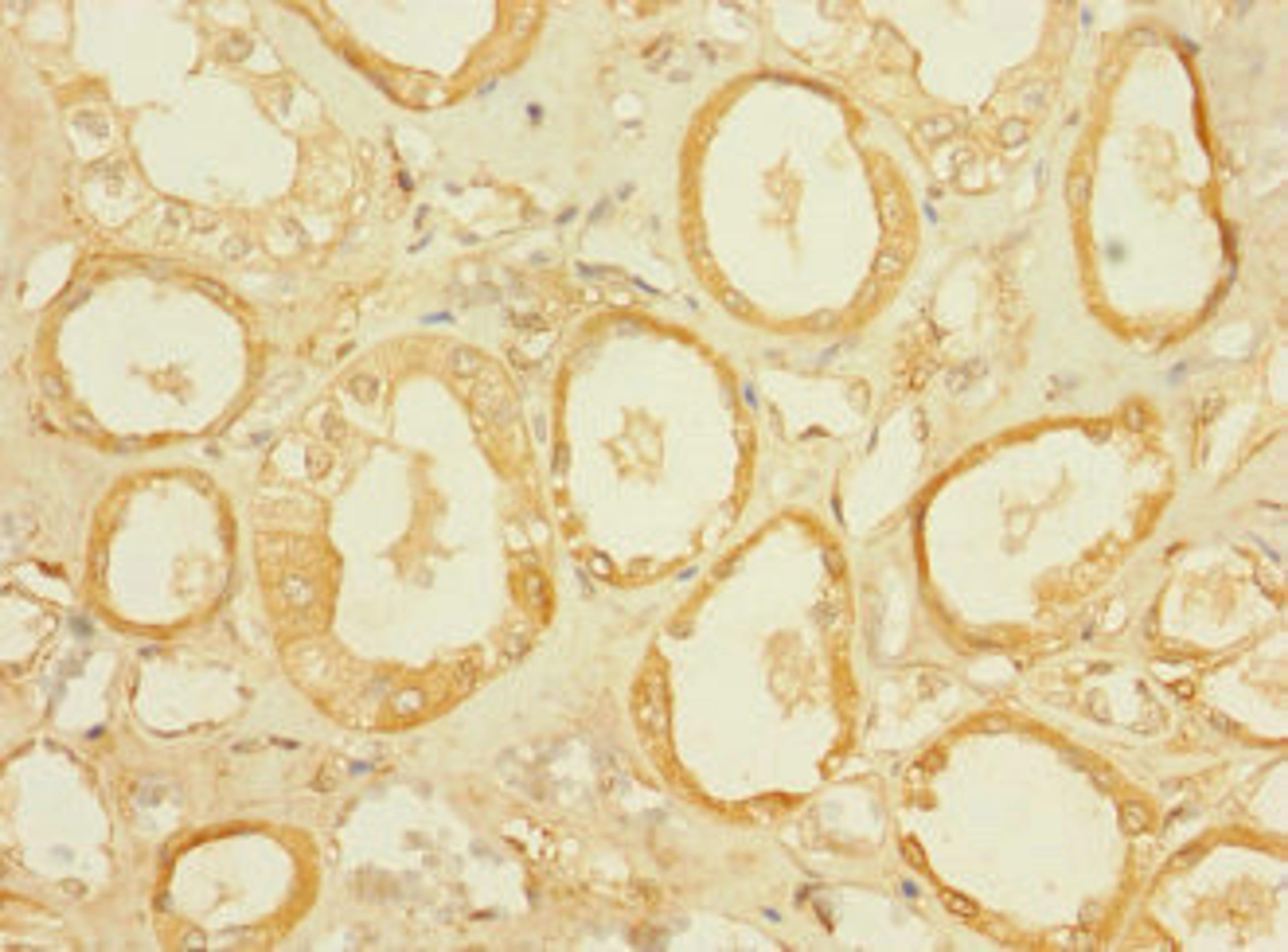Immunohistochemistry of paraffin-embedded human kidney tissue using CSB-PA021679LA01HU at dilution of 1:100
