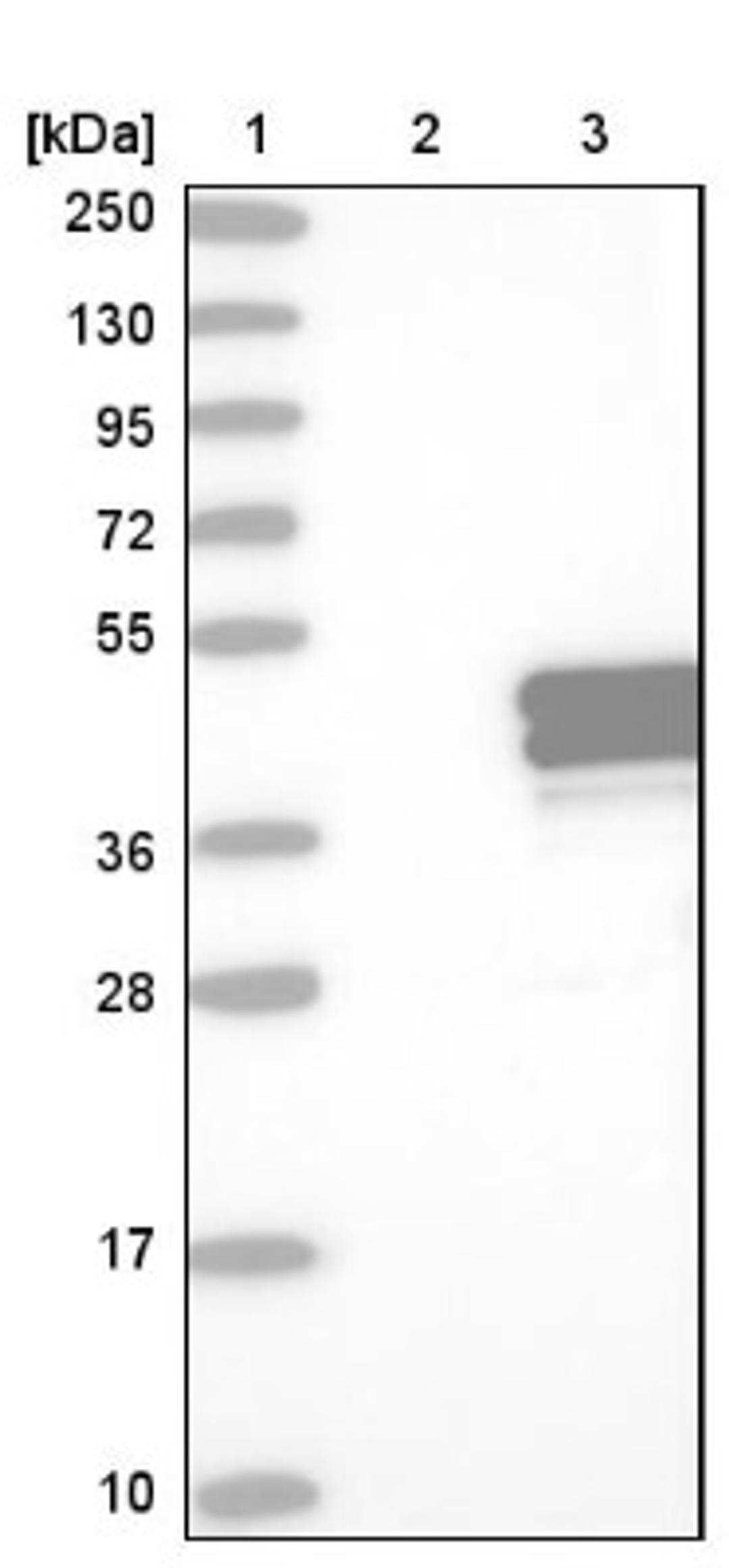 Western Blot: TRUB1 Antibody [NBP1-80866] - Lane 1: Marker [kDa] 250, 130, 95, 72, 55, 36, 28, 17, 10<br/>Lane 2: Negative control (vector only transfected HEK293T lysate)<br/>Lane 3: Over-expression lysate (Co-expressed with a C-terminal myc-DDK tag (~3.1 kDa) in mammalian HEK293T cells, LY408372)