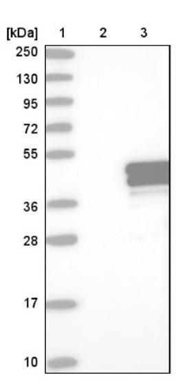 Western Blot: TRUB1 Antibody [NBP1-80866] - Lane 1: Marker [kDa] 250, 130, 95, 72, 55, 36, 28, 17, 10<br/>Lane 2: Negative control (vector only transfected HEK293T lysate)<br/>Lane 3: Over-expression lysate (Co-expressed with a C-terminal myc-DDK tag (~3.1 kDa) in mammalian HEK293T cells, LY408372)