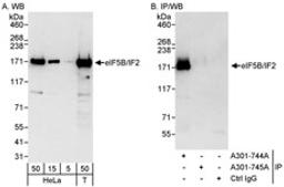 Detection of human eIF5B/IF2 by western blot and immunoprecipitation.