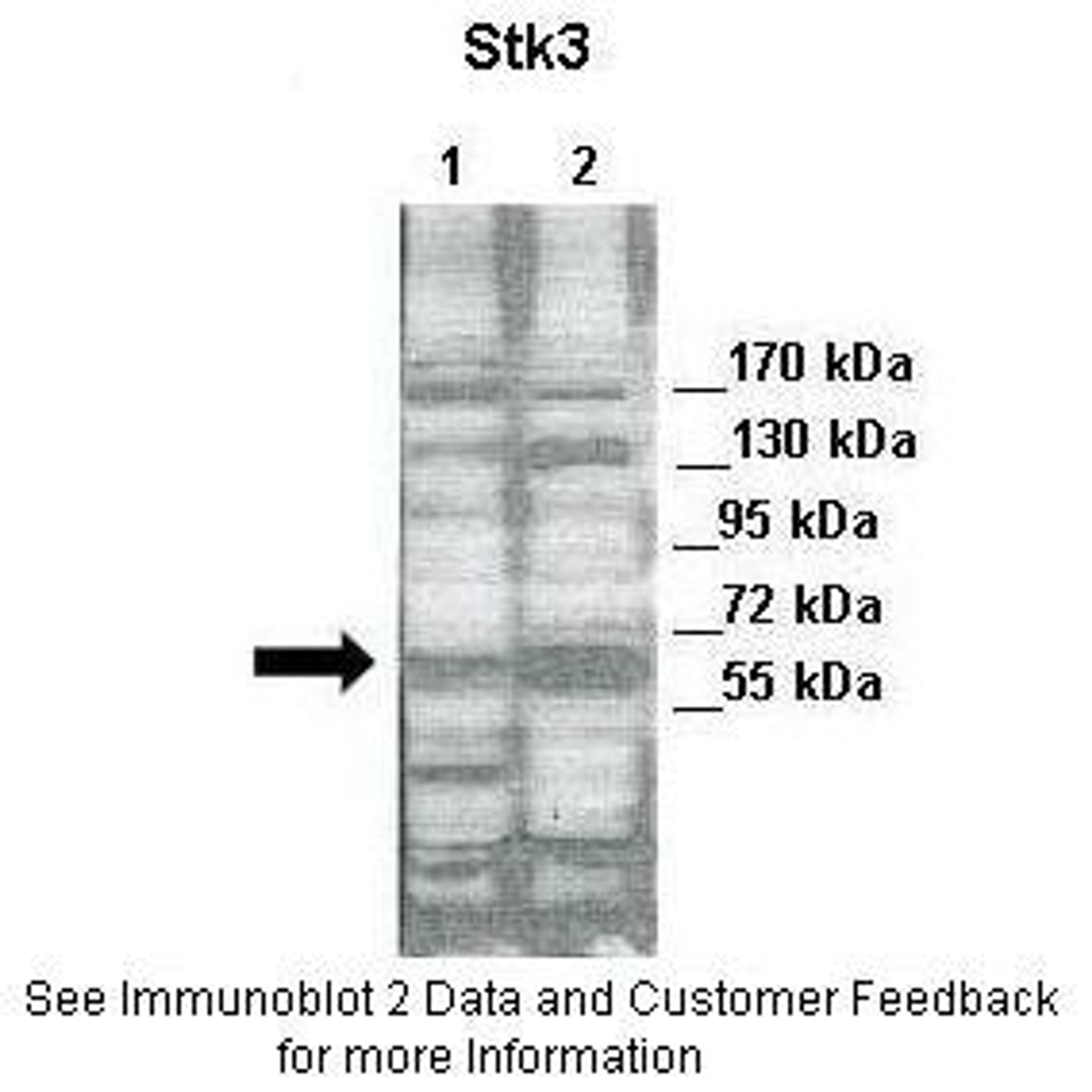 Antibody used in WB on Human cell lines at: 1:2000 (Lane 1: 30ug of HeLa cell lysate, Lane 2: 30ug of 293T cell lysate).