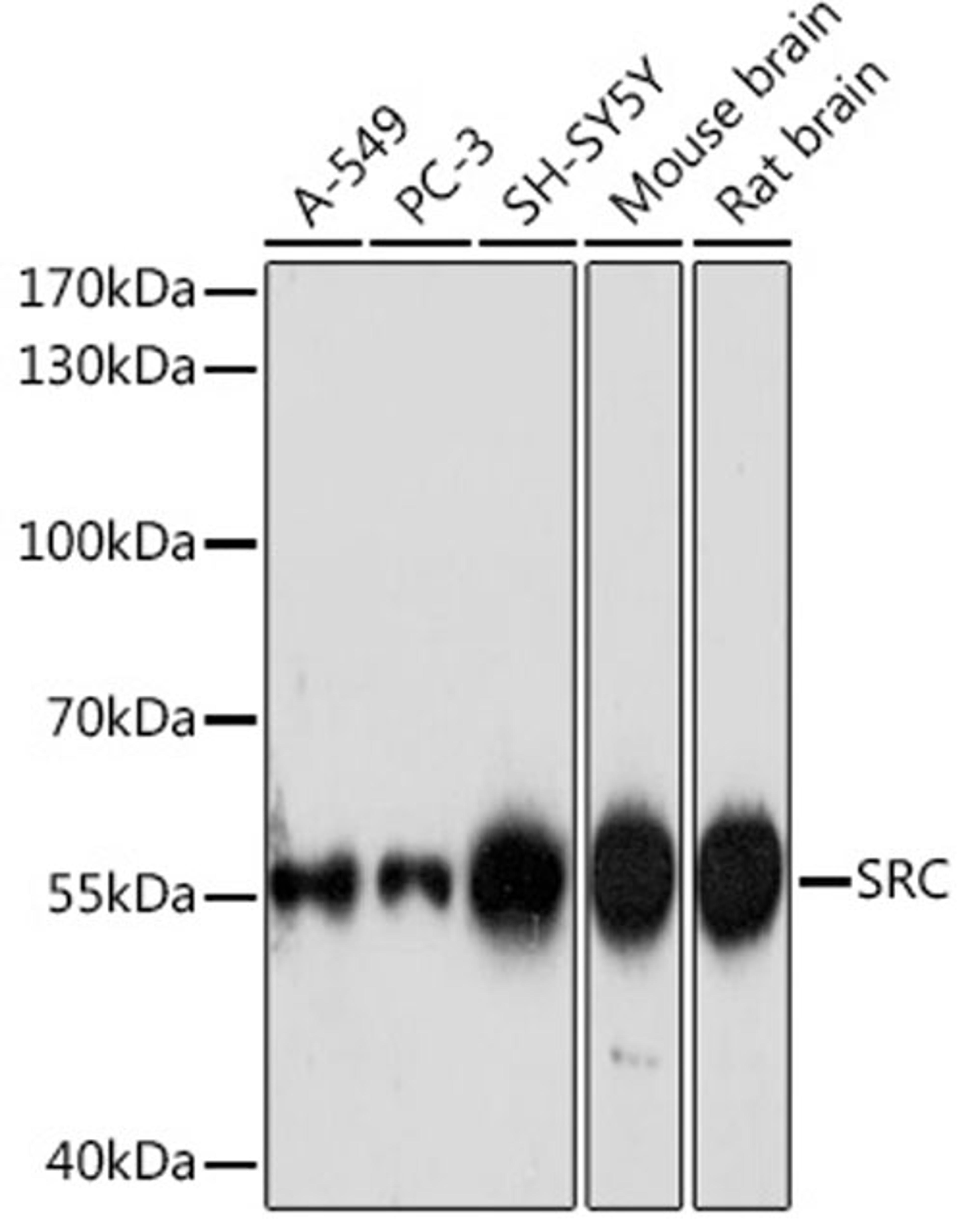 Western blot - SRC pAb (A18240)