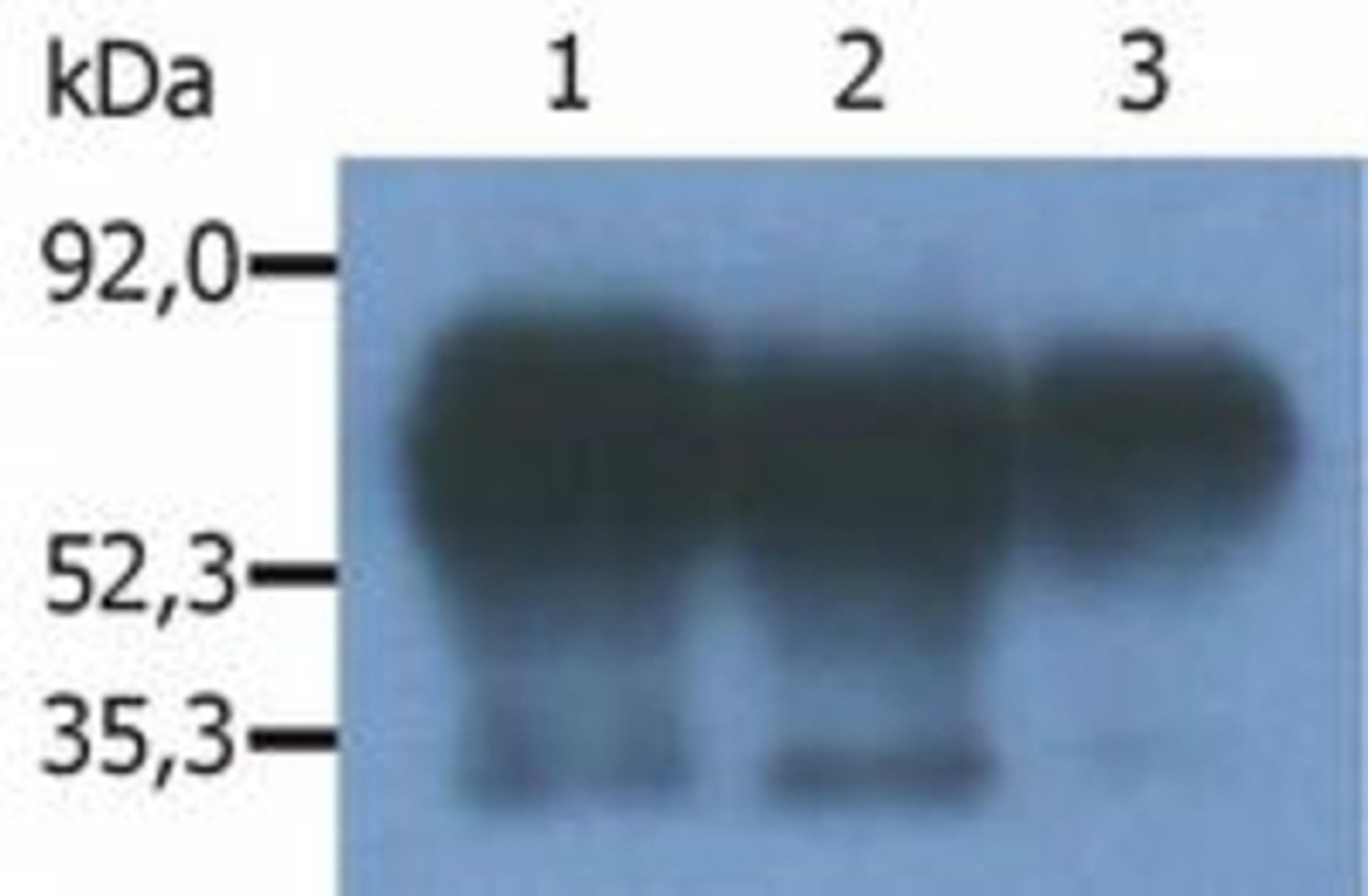 Immunoprecipitation: CSK Binding Protein Antibody (PAG-C1) [NB500-487] - Fig. 1. Immunoprecipitation of human Cbp/PAG from the lysate of RAJI human Burkitt lymphoma cell line. Western blot was immunostained with anti-human Cbp/PAG (MEM-255). Note: Csk-binding protein (Cbp/PAG) is a 46 kDa adaptor protein, which however migrates on SDS PAGE gels anomalously as an 80 kDa molecule. Lane 1,2: immunoprecipitation with anti-Cbp/PAG (PAG-C1) Lane 3: immunoprecipitation with anti-Cbp/PAG (polyclonal antibody).