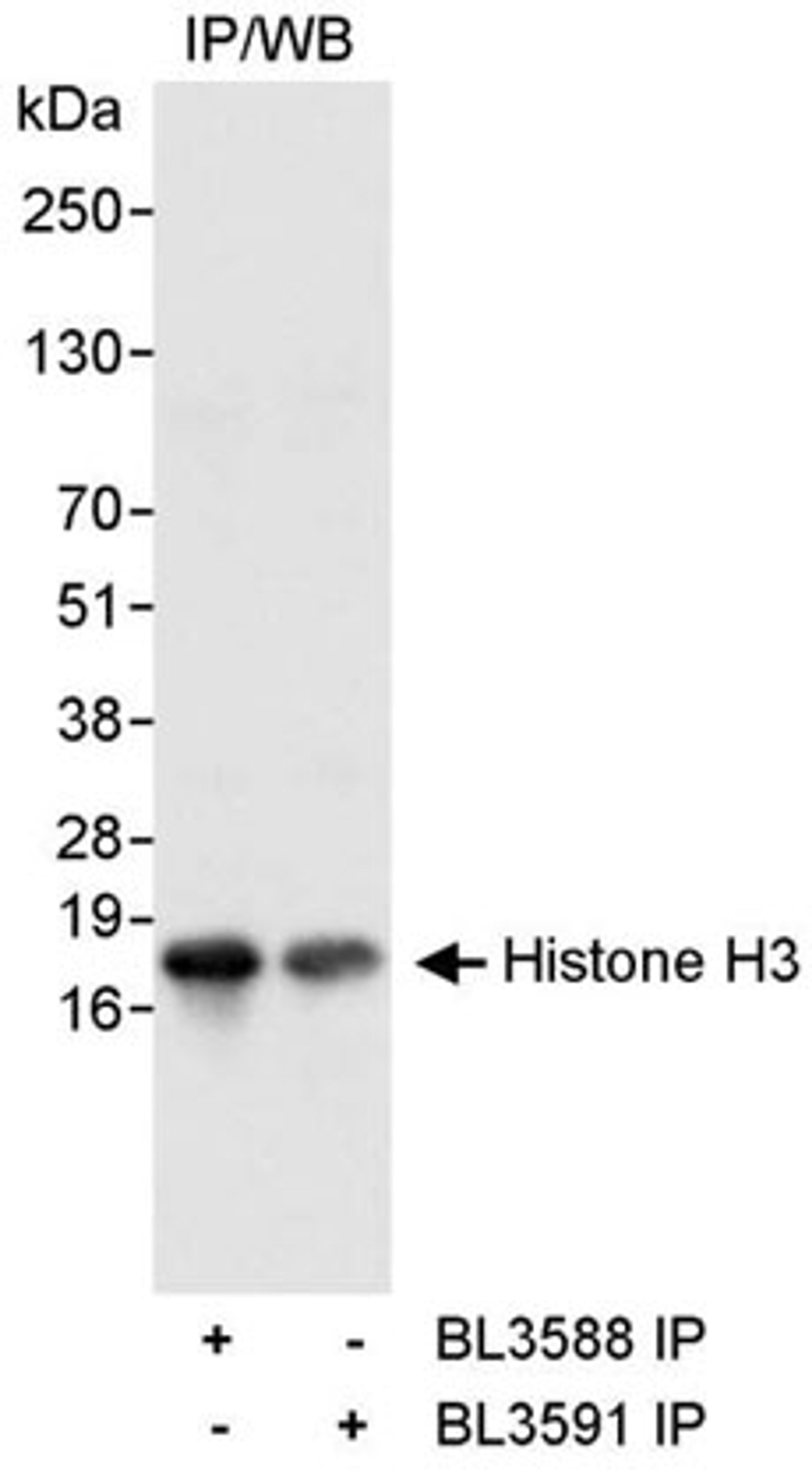 Detection of human Histone H3 by western blot of immunoprecipitates.