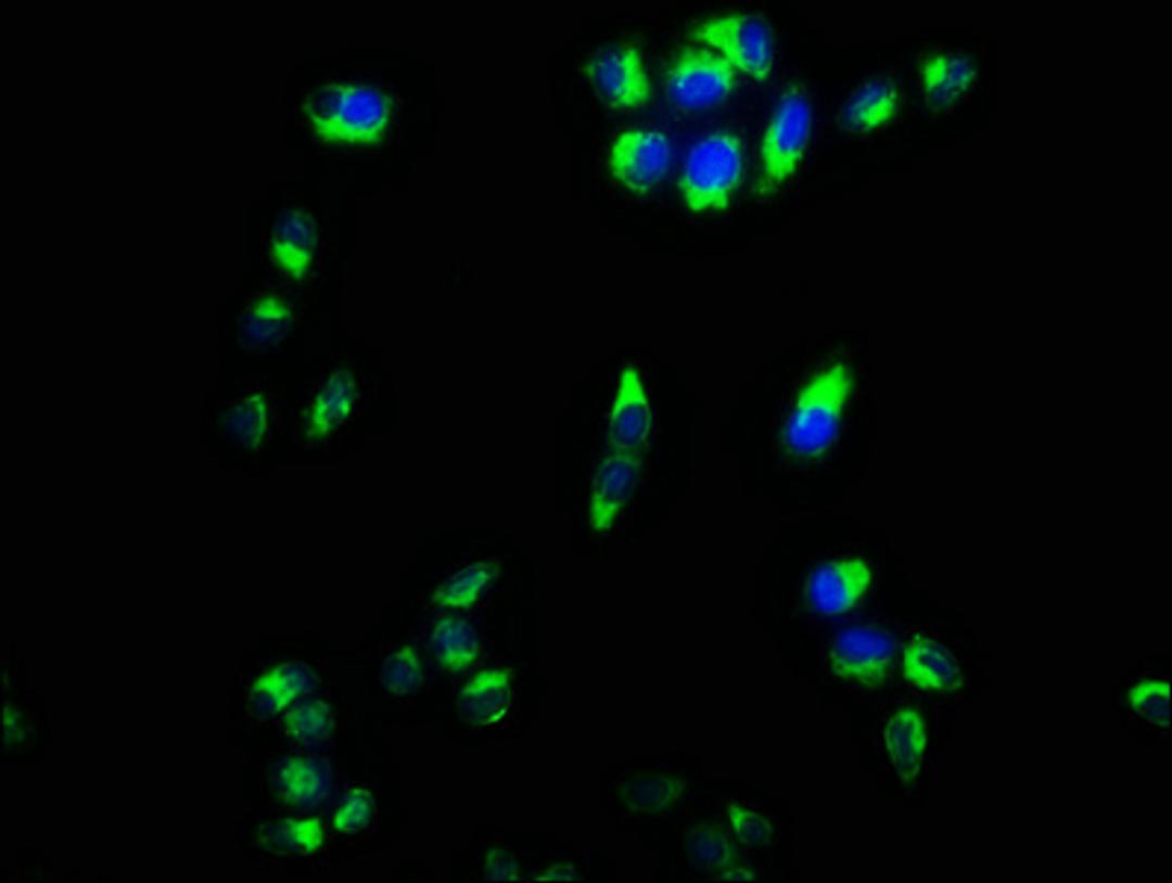 Immunofluorescence staining of Hela cells with CSB-PA618177LA01HU at 1:133, counter-stained with DAPI. The cells were fixed in 4% formaldehyde, permeabilized using 0.2% Triton X-100 and blocked in 10% normal Goat Serum. The cells were then incubated with the antibody overnight at 4°C. The secondary antibody was Alexa Fluor 488-congugated AffiniPure Goat Anti-Rabbit IgG(H+L).