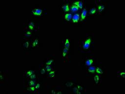 Immunofluorescence staining of Hela cells with CSB-PA618177LA01HU at 1:133, counter-stained with DAPI. The cells were fixed in 4% formaldehyde, permeabilized using 0.2% Triton X-100 and blocked in 10% normal Goat Serum. The cells were then incubated with the antibody overnight at 4°C. The secondary antibody was Alexa Fluor 488-congugated AffiniPure Goat Anti-Rabbit IgG(H+L).