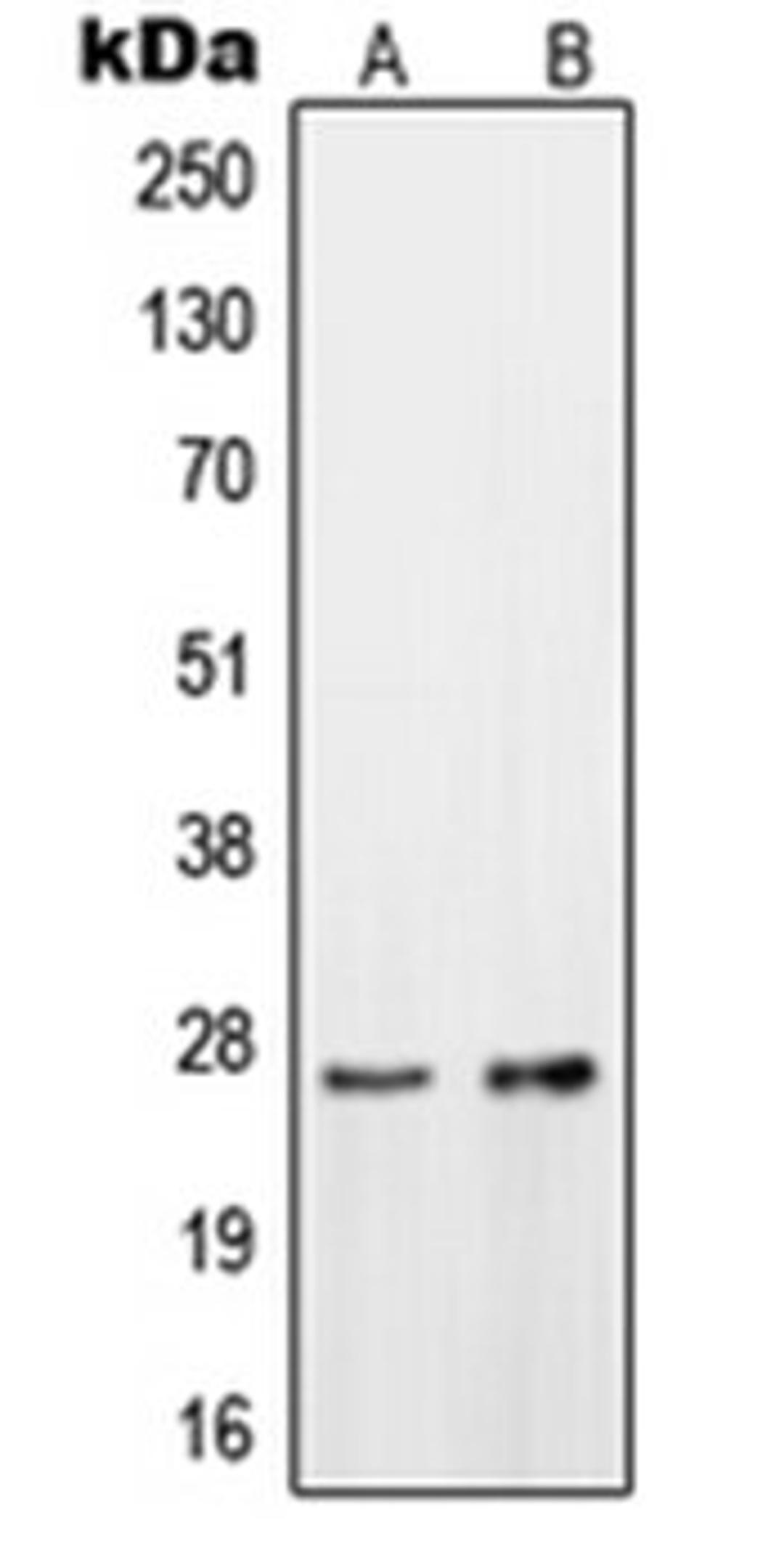 Western blot analysis of HeLa (Lane 1), HepG2 (Lane 2) whole cell lysates using OTUB2 antibody