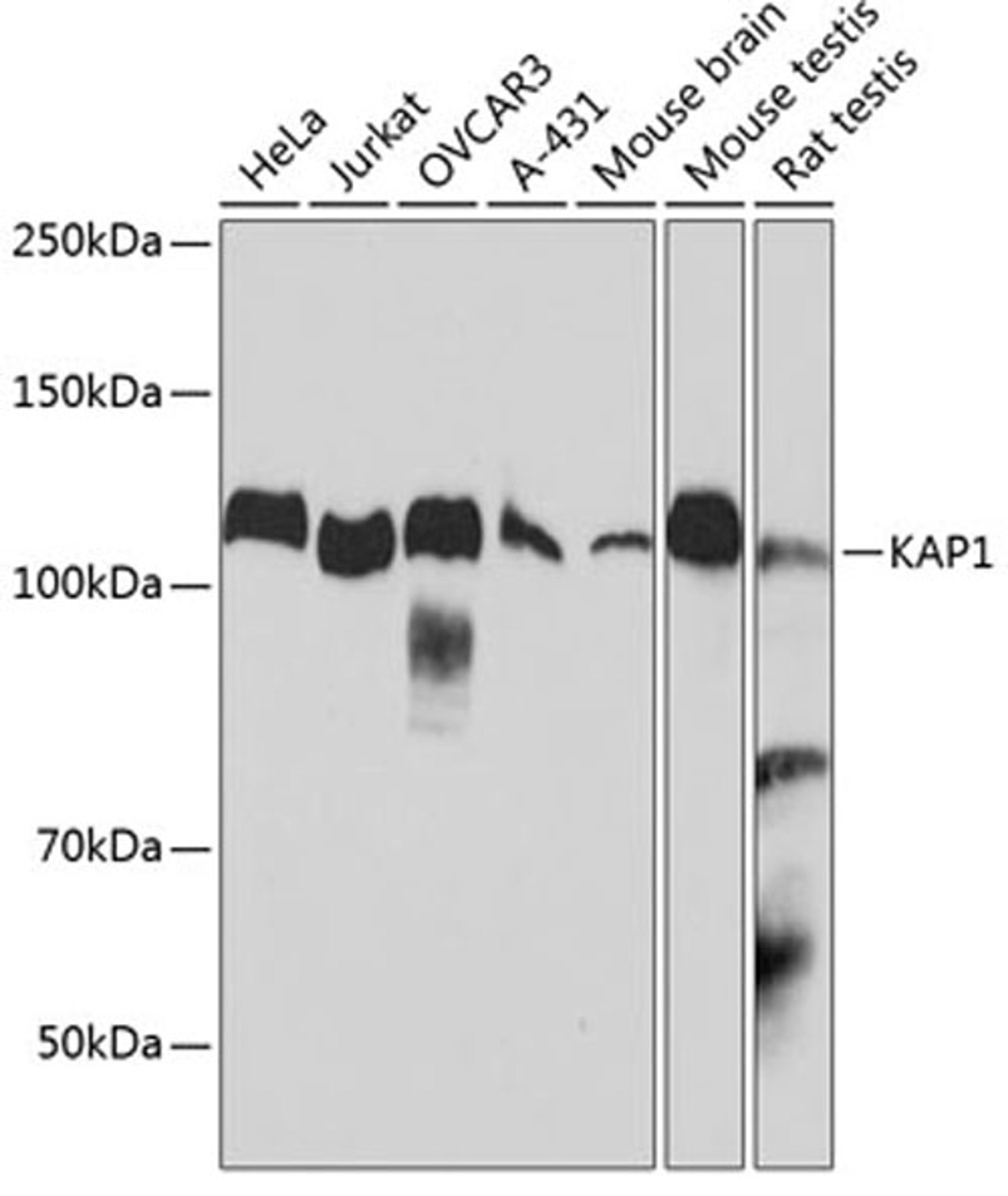 Western blot - KAP1 antibody (A19568)