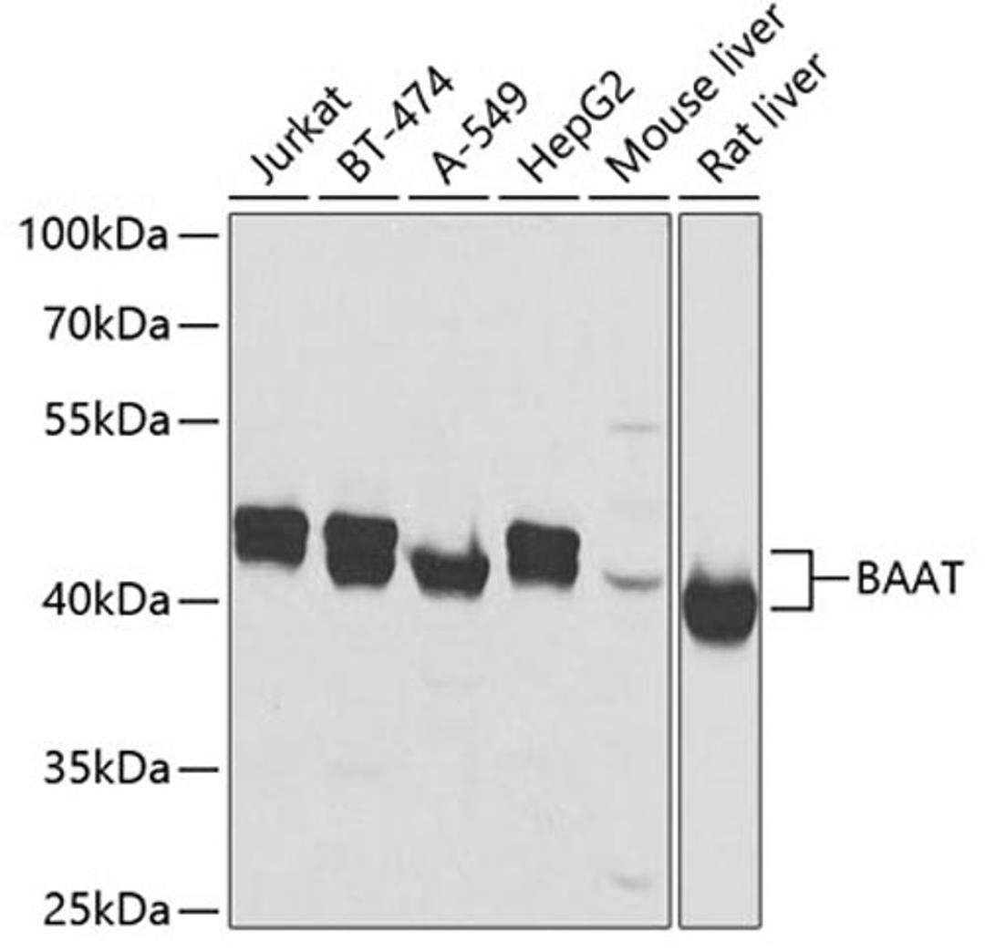 Western blot - BAAT antibody (A7646)