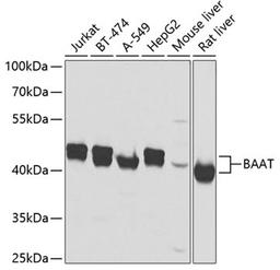 Western blot - BAAT antibody (A7646)