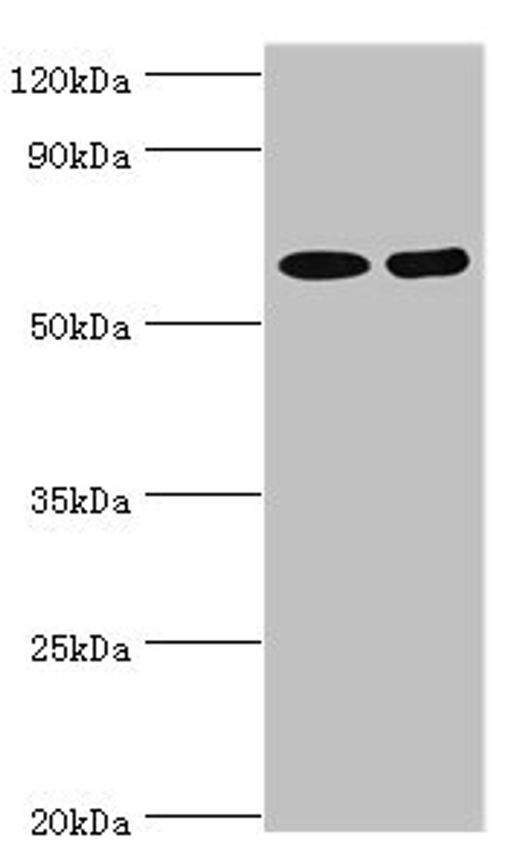 Western blot. All lanes: N-acetylserotonin O-methyltransferase-like protein antibody at 2ug/ml. Lane 1: Hela whole cell lysate. Lane 2: A549 whole cell lysate. Secondary. Goat polyclonal to rabbit IgG at 1/10000 dilution. Predicted band size: 69, 68, 63 kDa. Observed band size: 69 kDa.