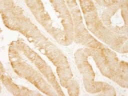 Detection of human vPARP by immunohistochemistry.