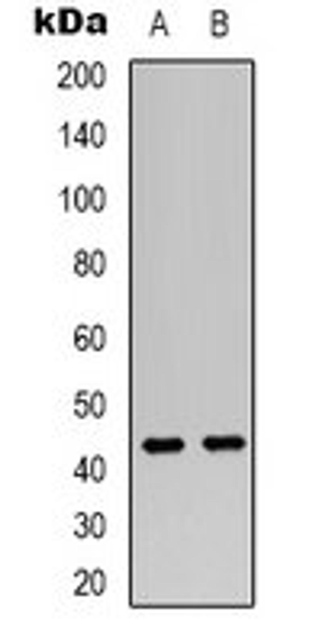 Western blot analysis of MCF7 (Lane 1), HuvEc (Lane 2) whole cell lysates using VN1R2 antibody