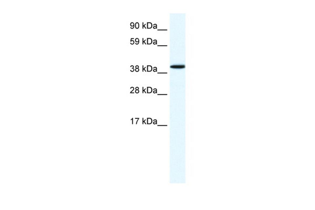 Antibody used in WB on Human Liver at 1.25 ug/ml.