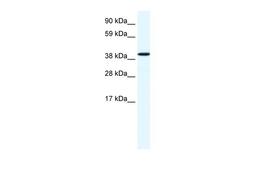 Antibody used in WB on Human Liver at 1.25 ug/ml.