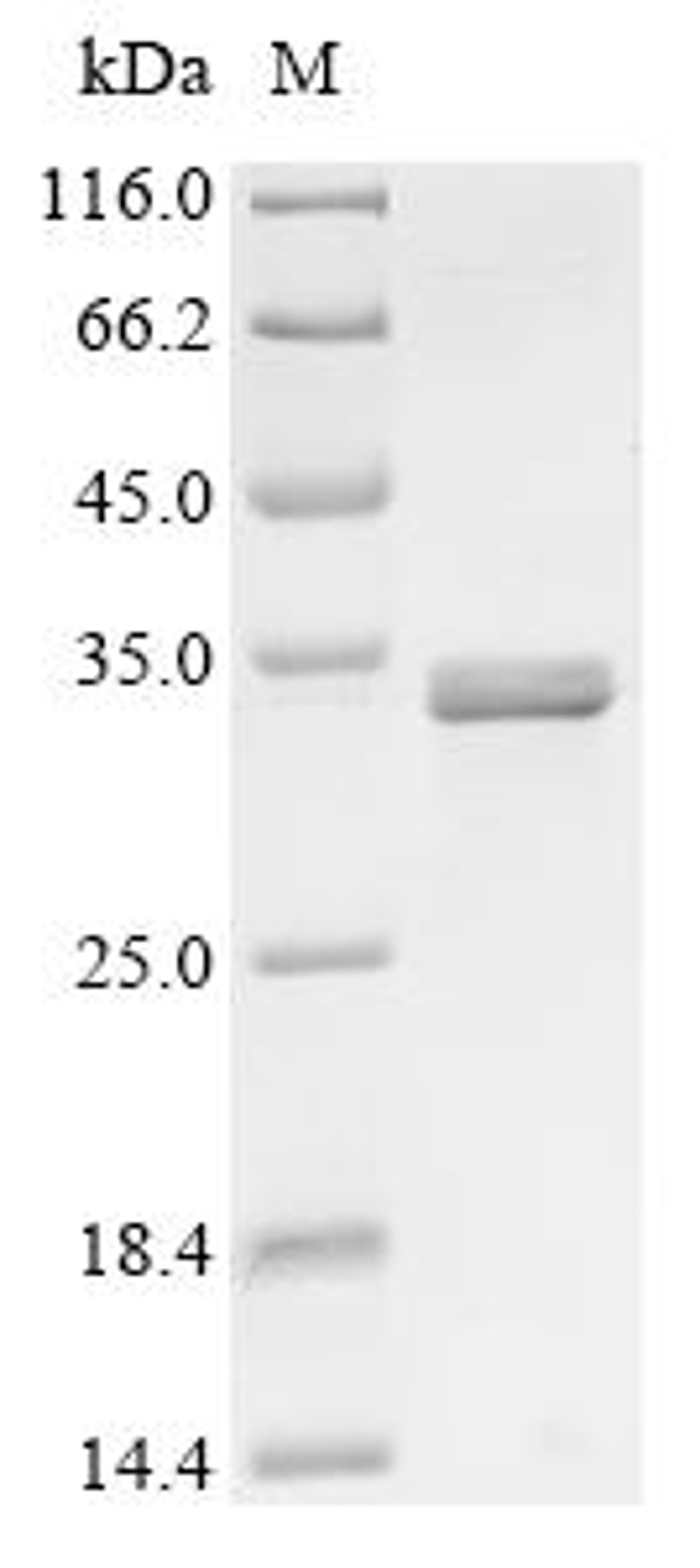 (Tris-Glycine gel) Discontinuous SDS-PAGE (reduced) with 5% enrichment gel and 15% separation gel.