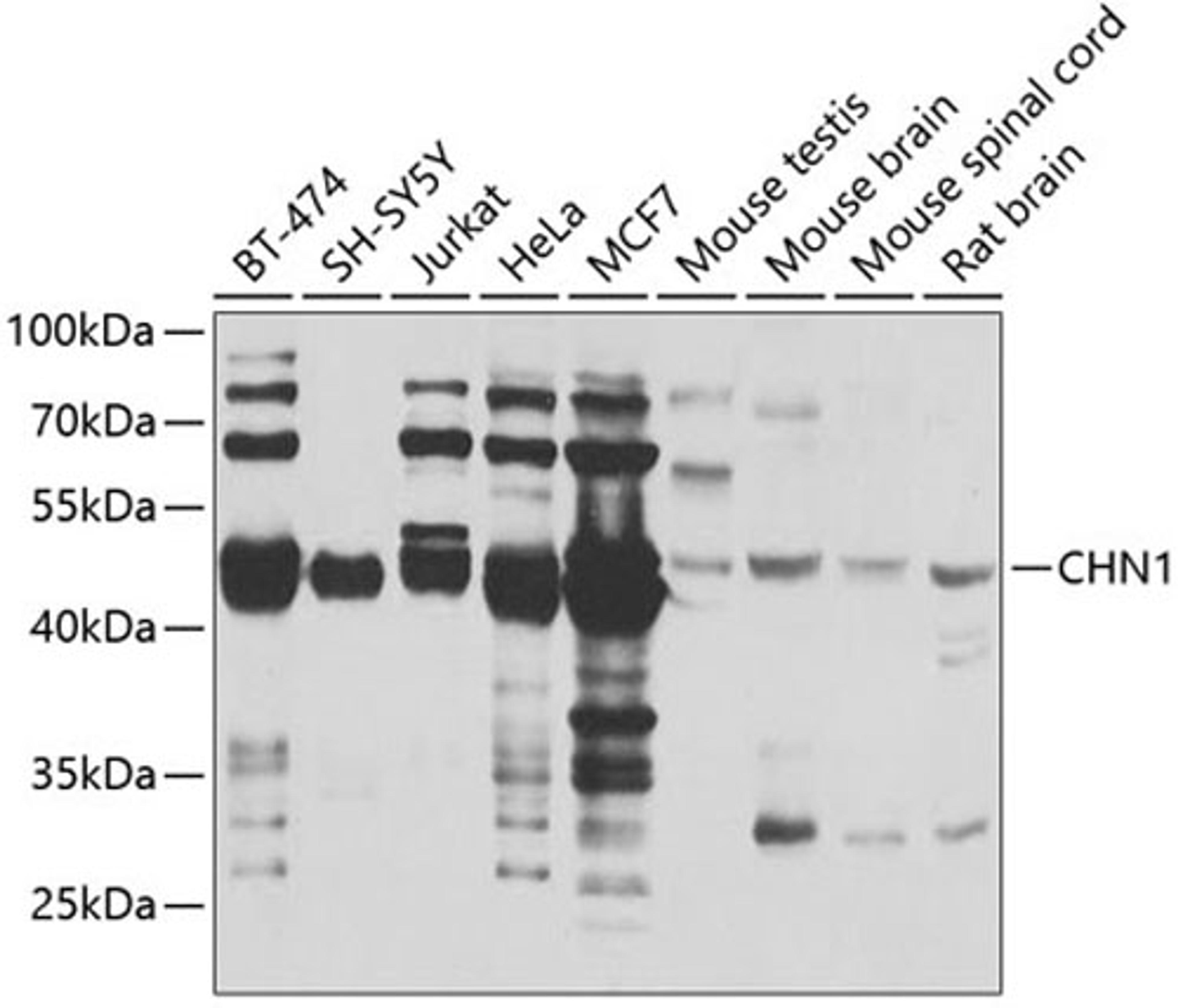 Western blot - CHN1 antibody (A7546)