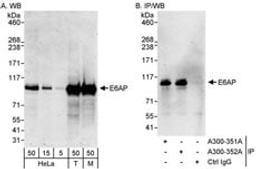 Detection of human and mouse E6AP by western blot and immunoprecipitation.