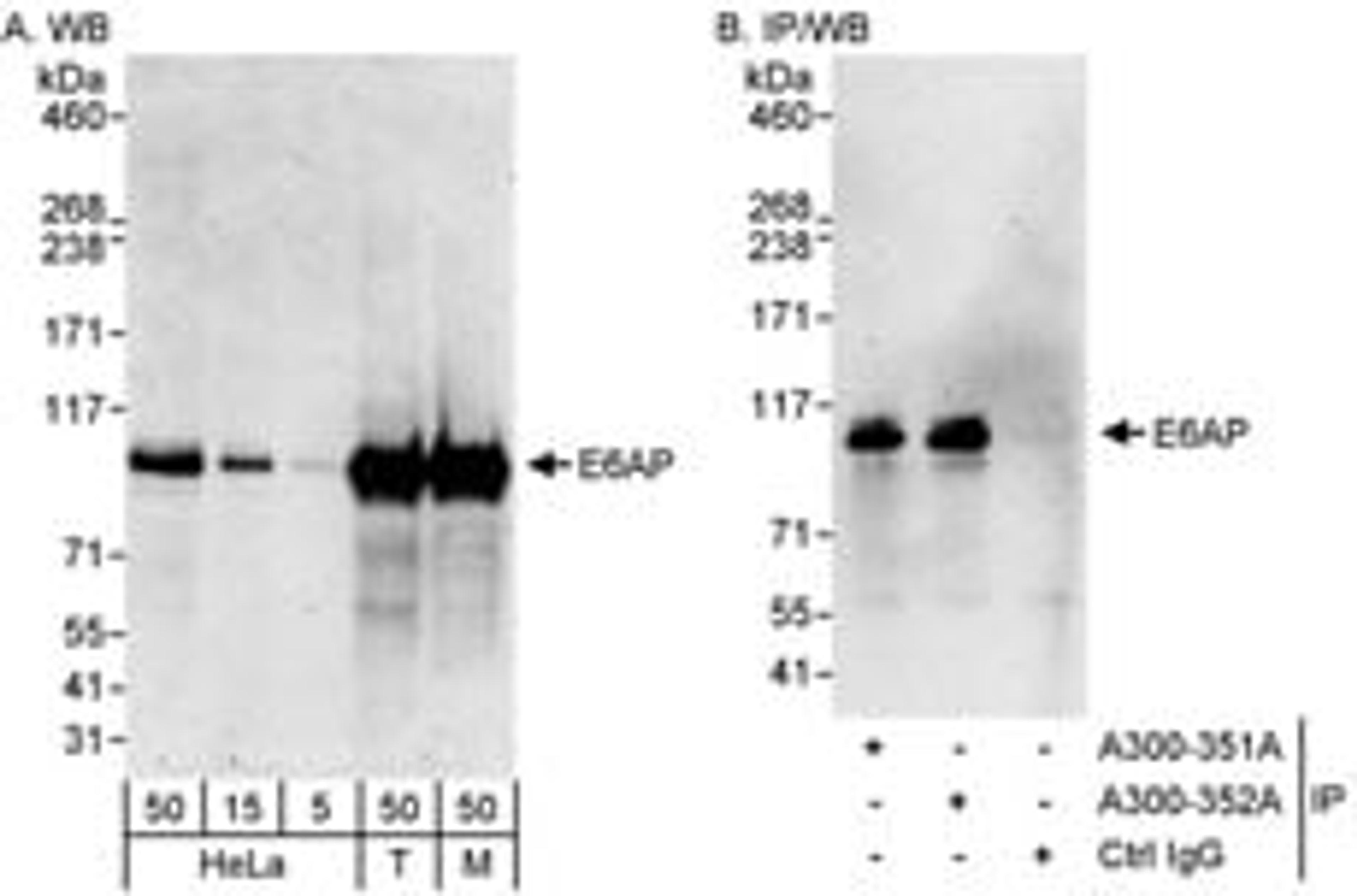 Detection of human and mouse E6AP by western blot and immunoprecipitation.