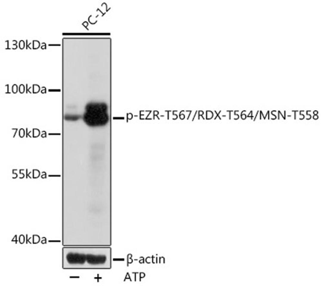 Western blot - Phospho-EZR-T567/RDX-T564/MSN-T558 Rabbit pAb (AP1121)