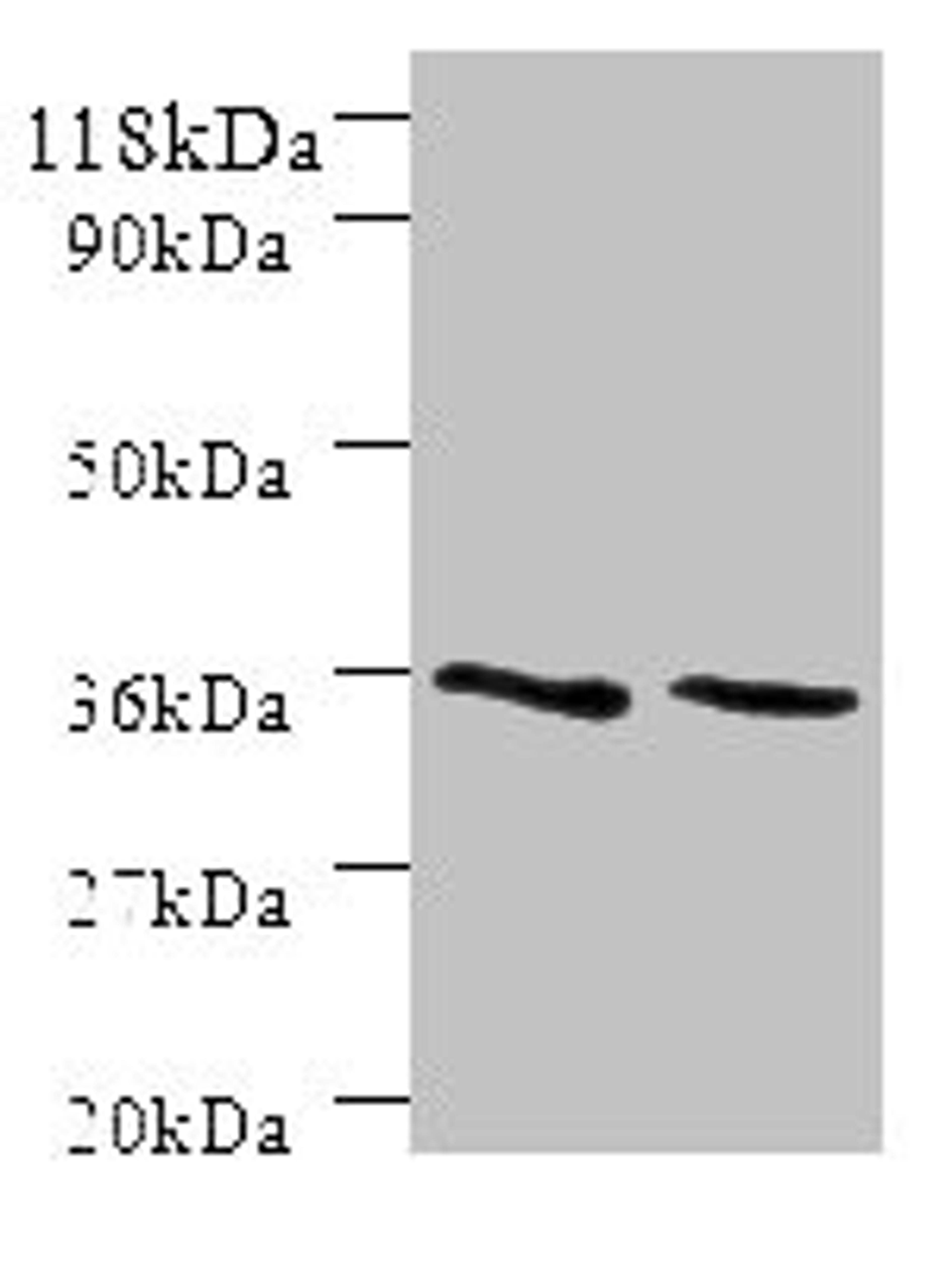 Western blot. All lanes: SNX20 antibody at 2µg/ml. Lane 1: Mouse spleen tissue. Lane 2: Mouse skeletal muscle tissue. Secondary. Goat polyclonal to rabbit IgG at 1/10000 dilution. Predicted band size: 37, 18, 15, 12 kDa. Observed band size: 37 kDa