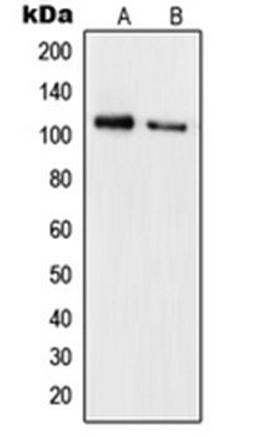 Western blot analysis of Jurkat FBS-treated (Lane 1), HeLa (Lane 2) whole cell lysates using RB1 antibody