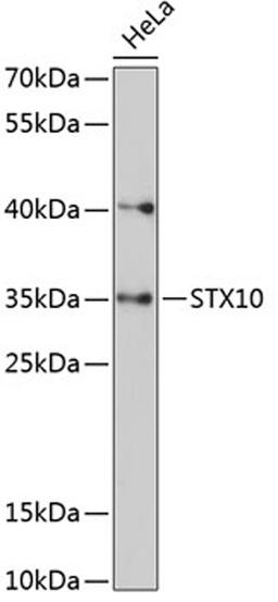 Western blot - STX10 antibody (A13827)