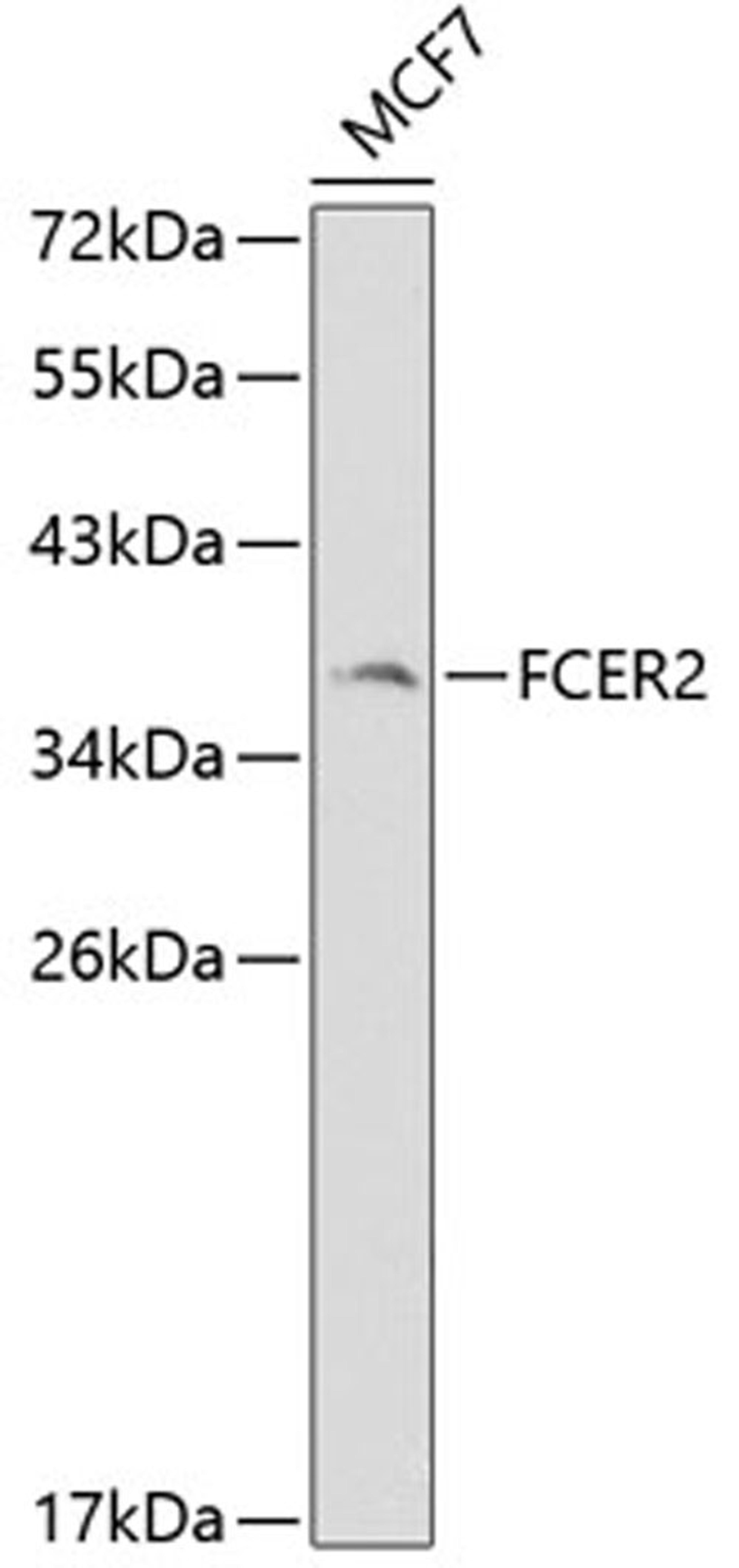 Western blot - FCER2 antibody (A1839)