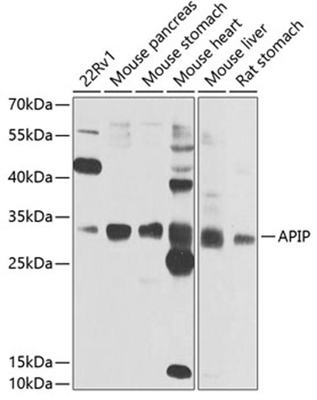 Western blot - APIP antibody (A7102)