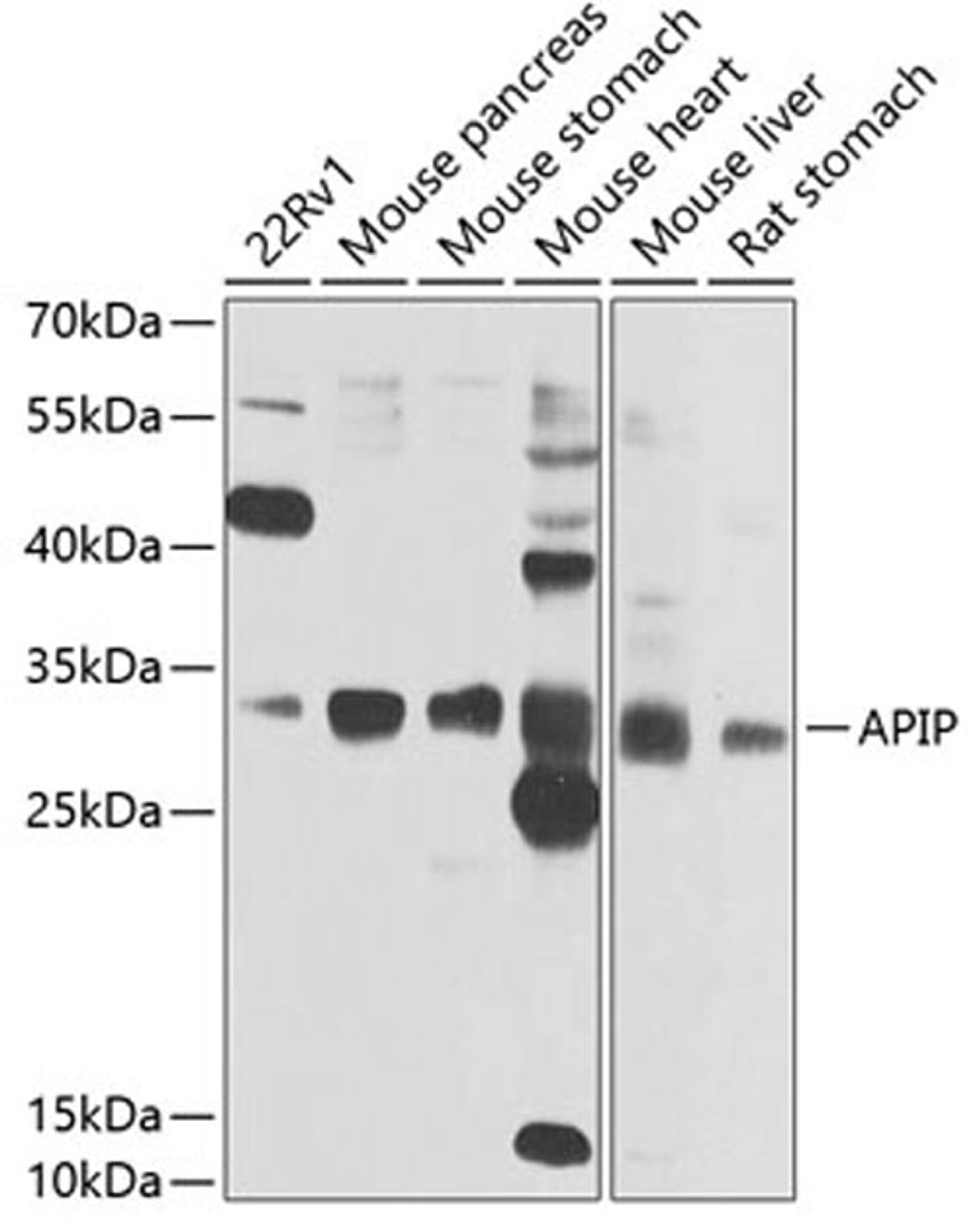 Western blot - APIP antibody (A7102)