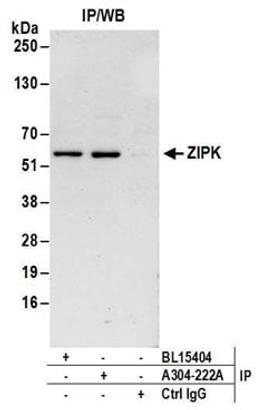 Detection of human ZIPK by western blot of immunoprecipitates.