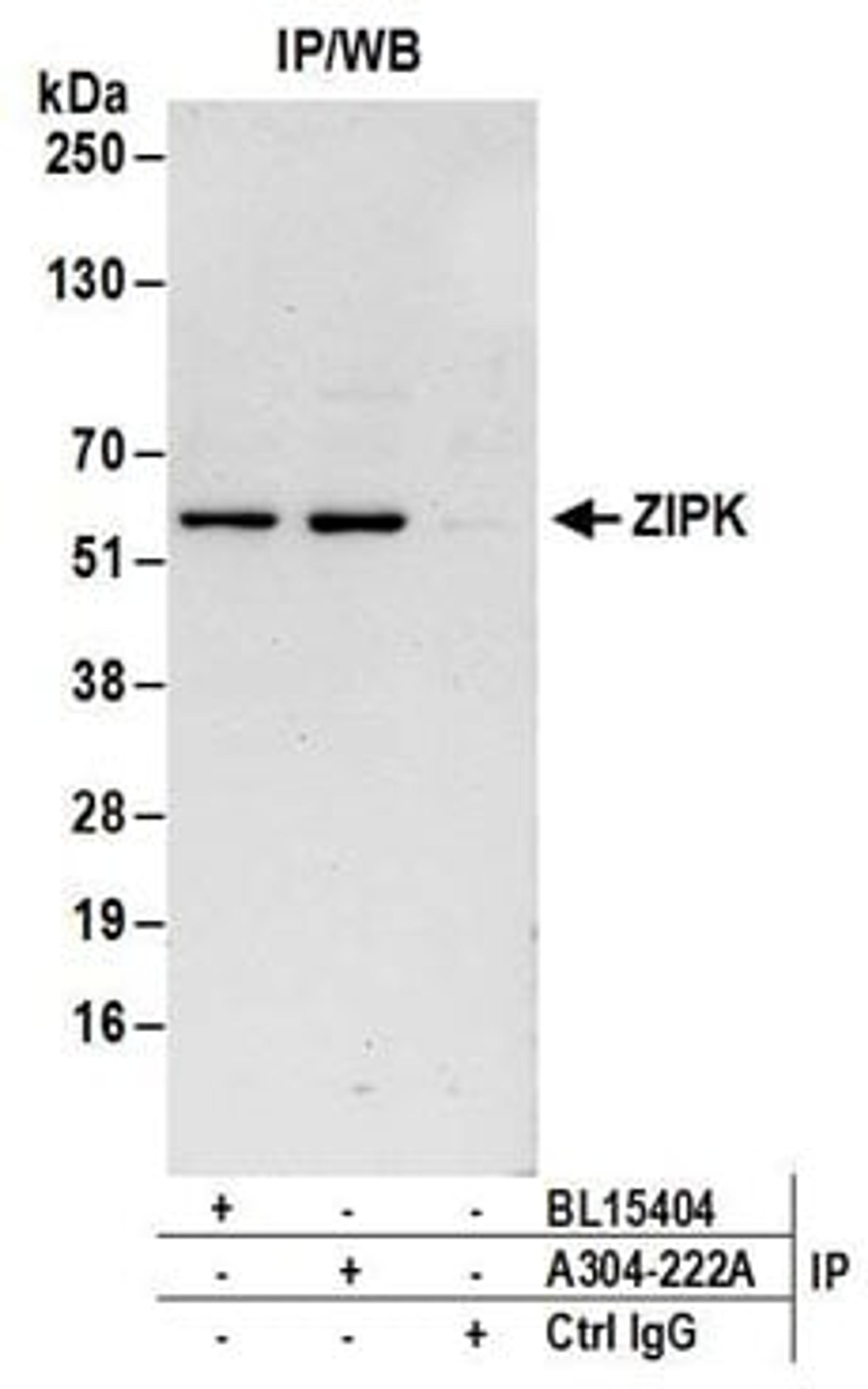 Detection of human ZIPK by western blot of immunoprecipitates.