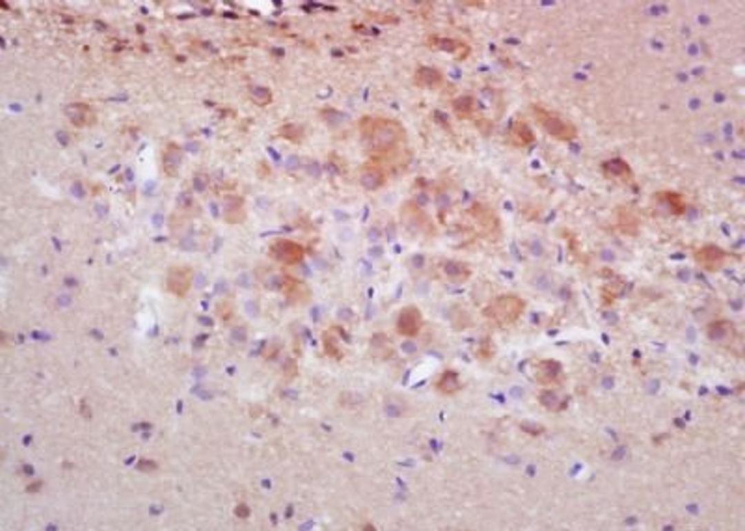 Immunohistochemical analysis of formalin-fixed paraffin embedded mouse lung tissue using pro Caspase 3 antibody (dilution at 1:200)