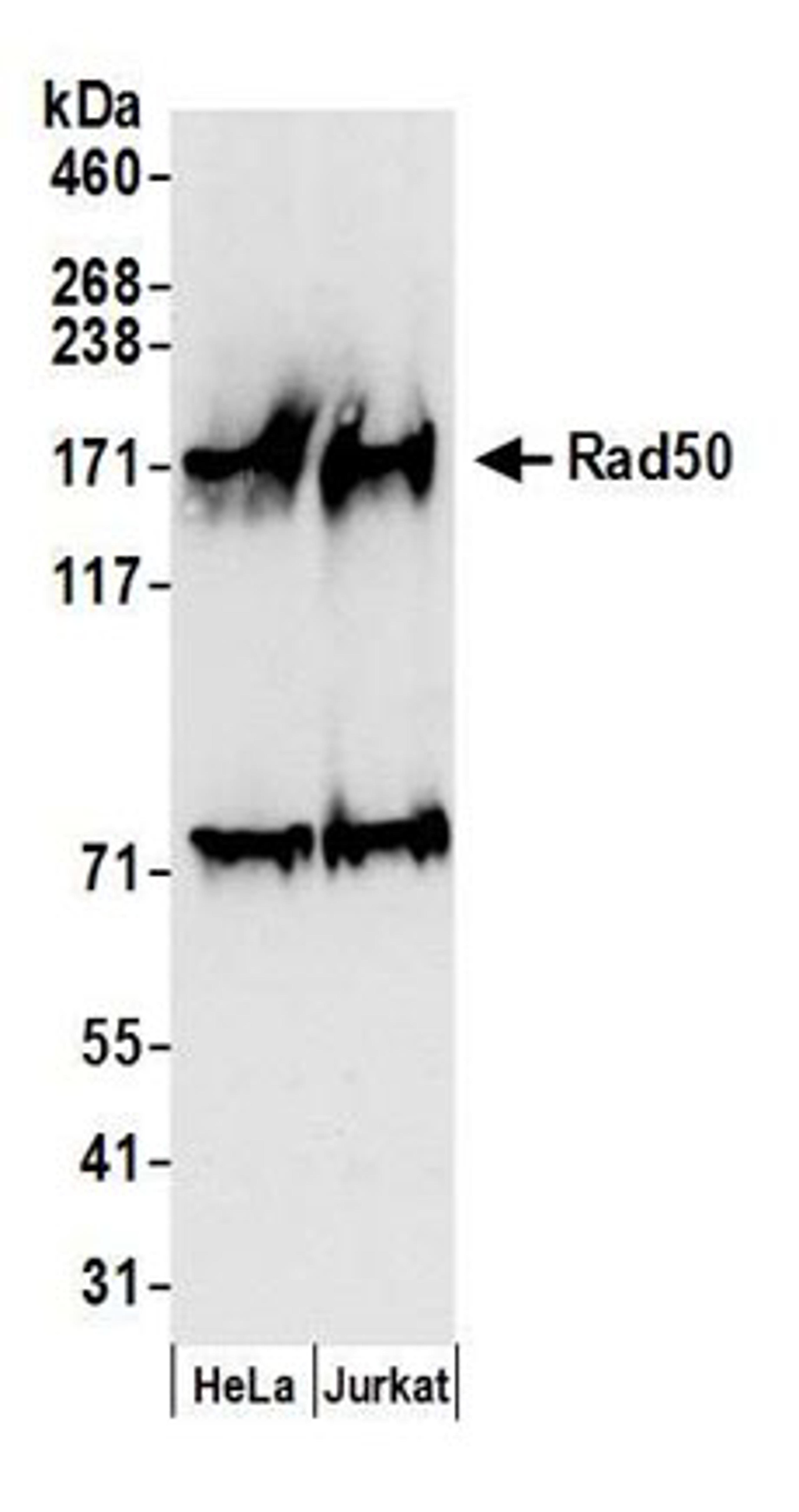 Detection of human Rad50 by western blot.