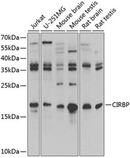 Western blot - CIRBP antibody (A6080)