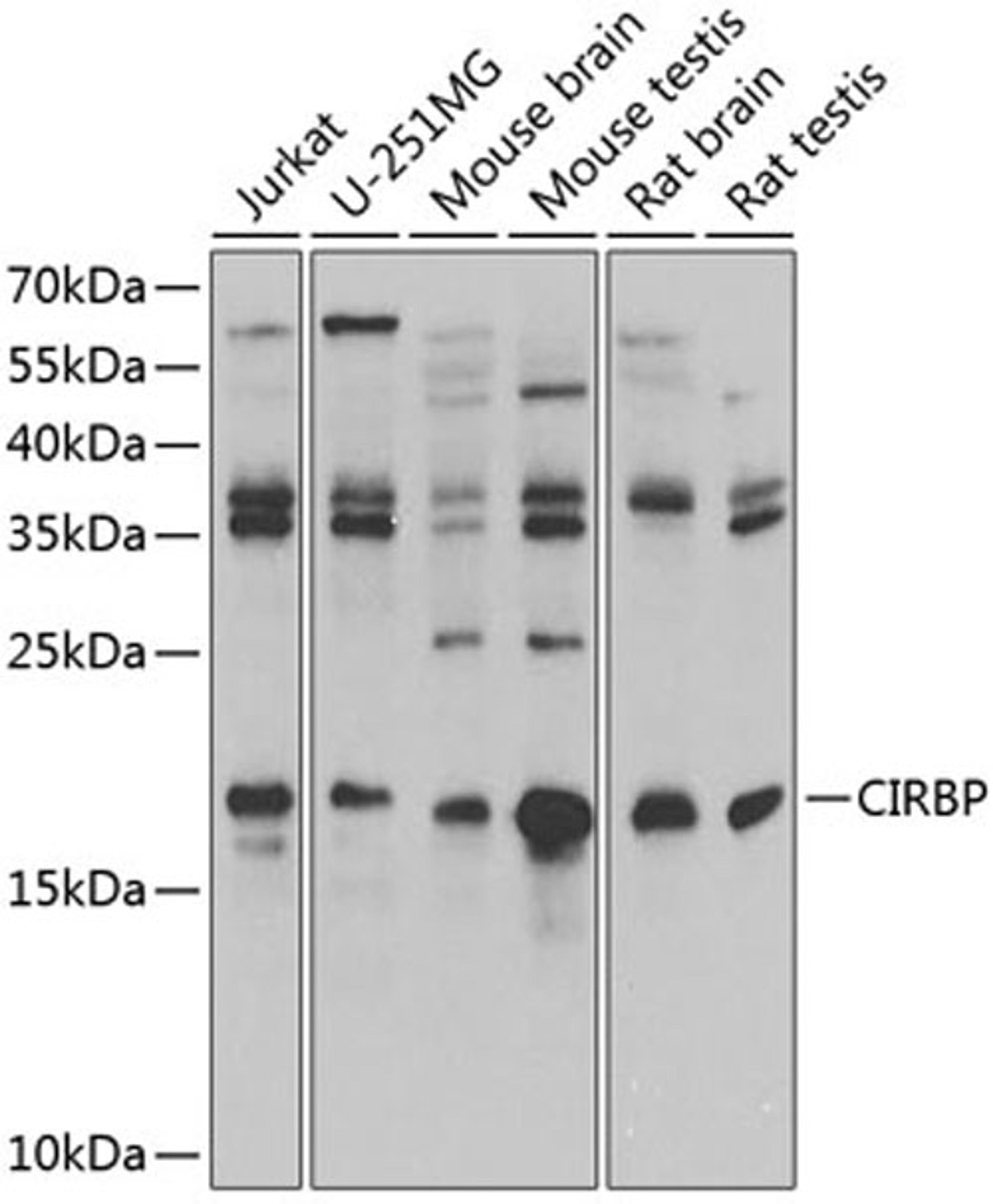 Western blot - CIRBP antibody (A6080)