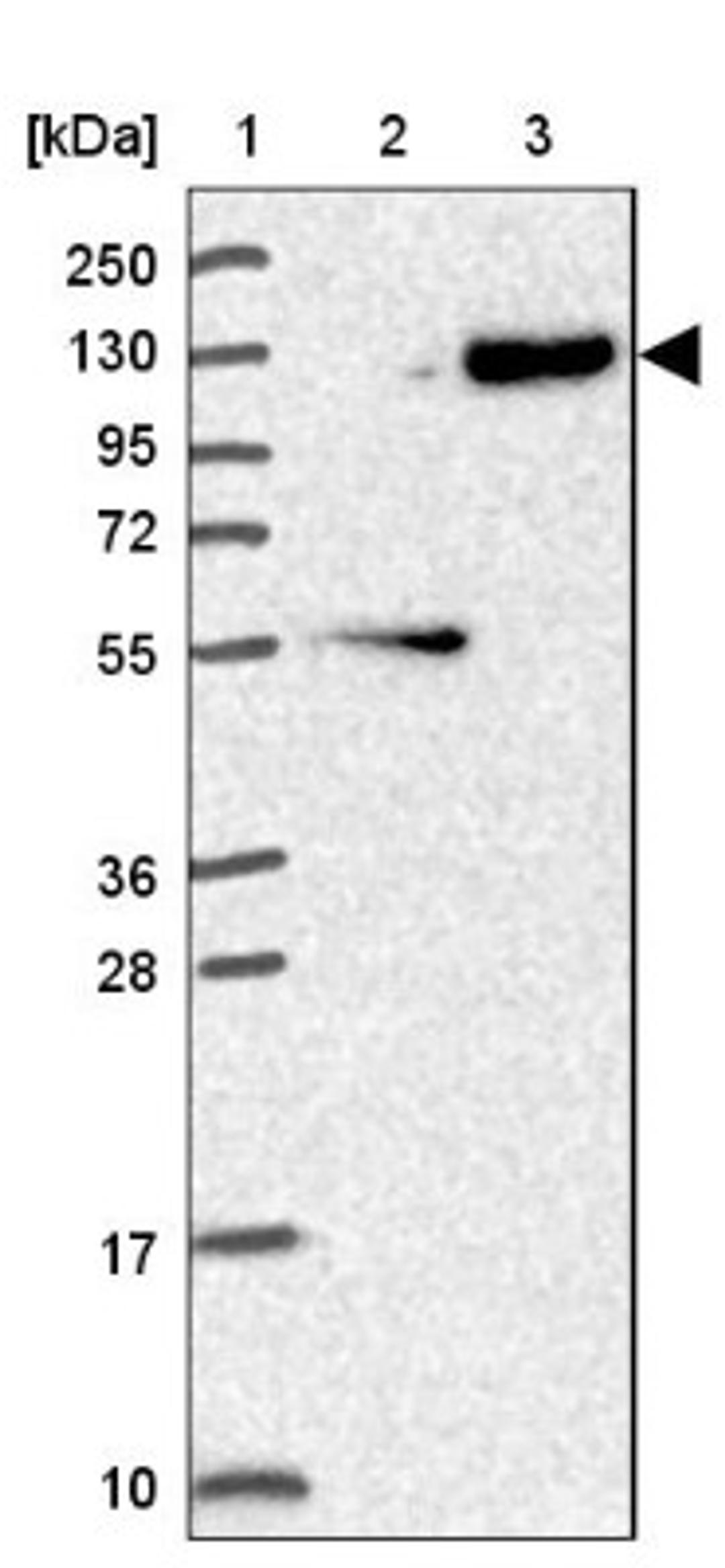 Western Blot: LONRF3 Antibody [NBP2-47391] - Lane 1: Marker [kDa] 250, 130, 95, 72, 55, 36, 28, 17, 10.  Lane 2: Human cell line RT-4.  Lane 3: Human cell line U-251MG.