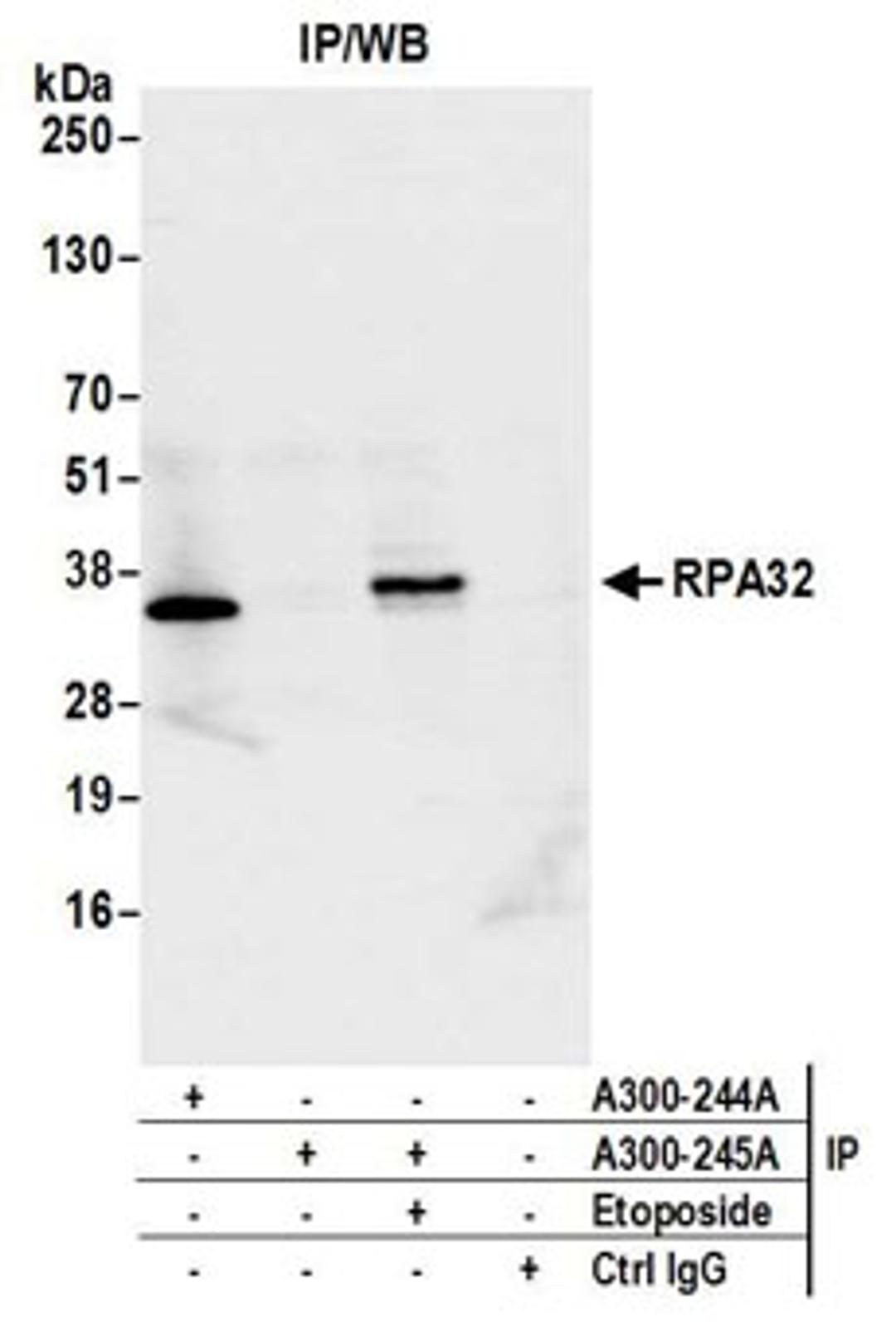 Detection of human RPA32 by western blot of immunoprecipitates.