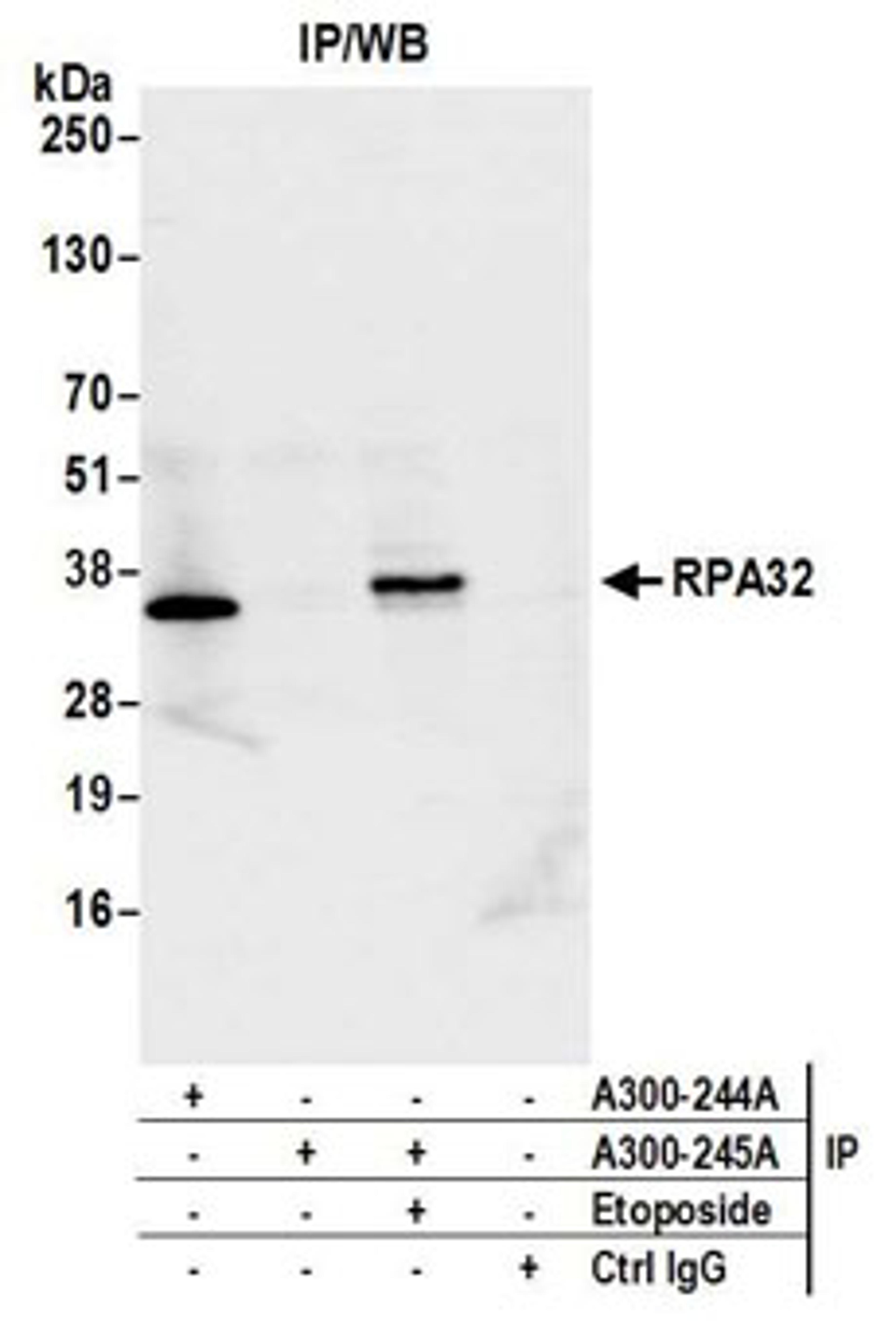 Detection of human RPA32 by western blot of immunoprecipitates.