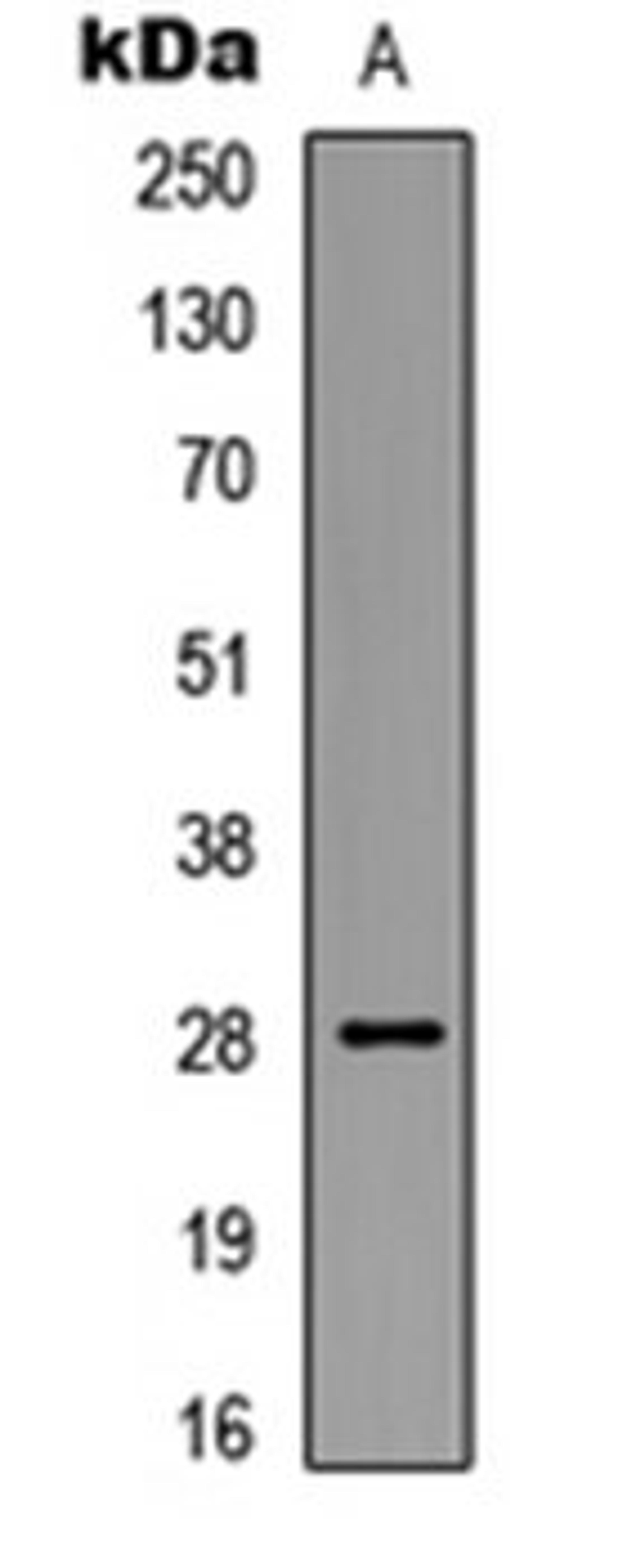 Western blot analysis of HEK293T UV-treated (Lane 1) whole cell lysates using BCL2 (phospho-S87) antibody